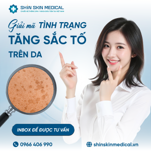 Giải Mã Tình Trạng Tăng Sắc Tố Da: Nguyên Nhân Cốt Lõi Và Giải Pháp Kiểm Soát Chuẩn Y Khoa